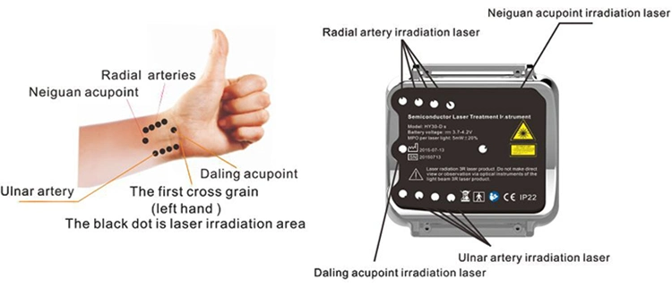 Hnc Factory Cardiovascular Diseases Low Level Laser Therapy Instrument