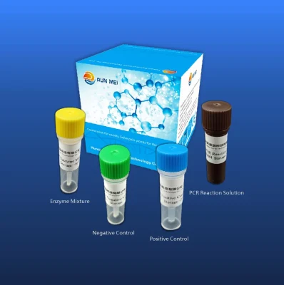 Kit de detección de ácido nucleico del virus de la influenza aviar
